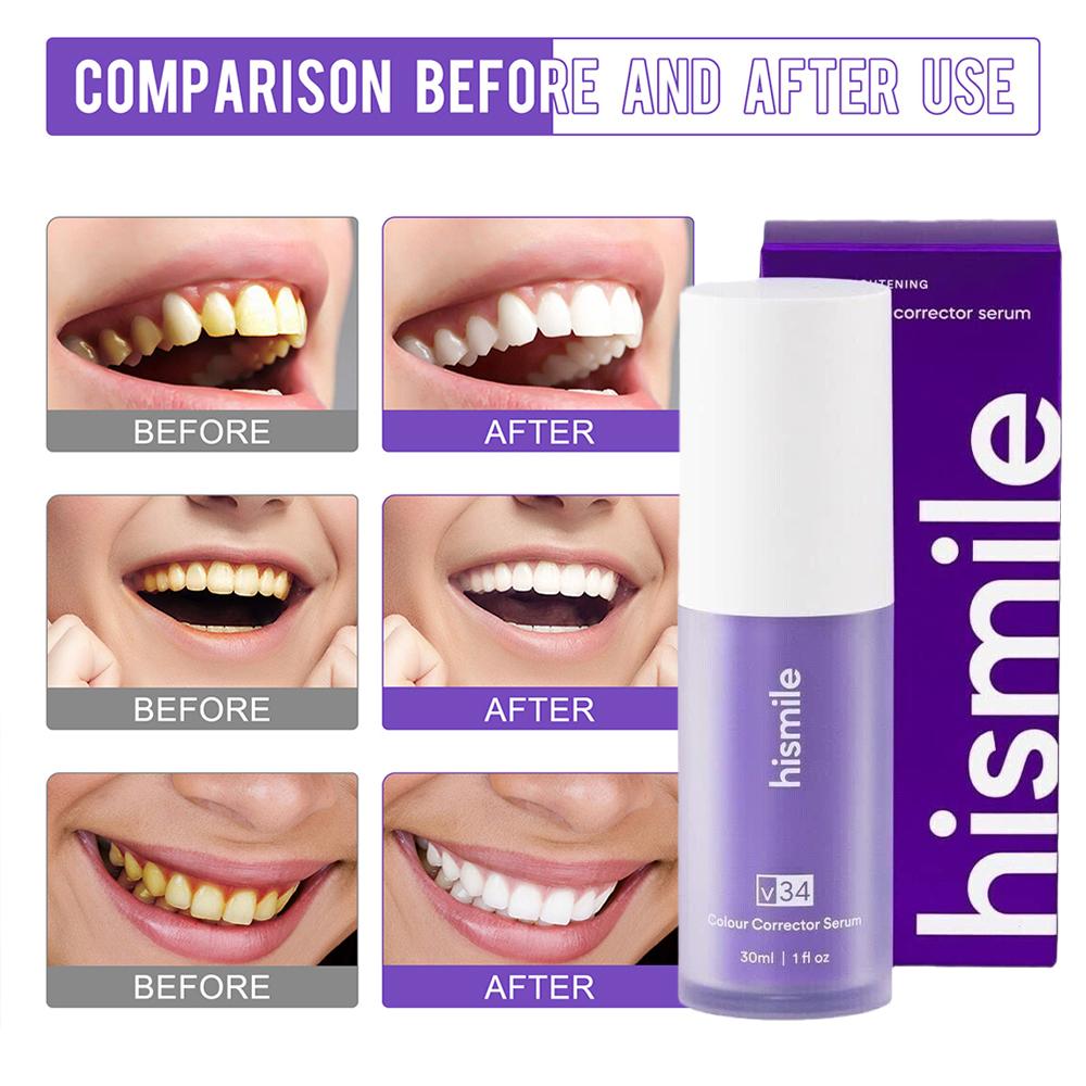 Teeth Whitening Crest - 30ml Hismile V34 Purple Teeth Whitening