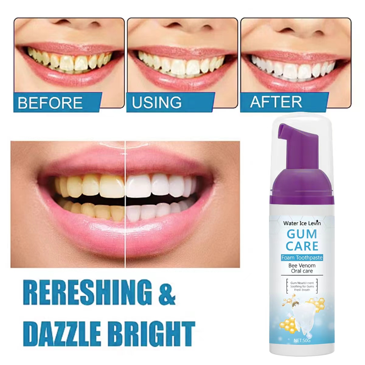 Water Ice Levin Gum Care Foam  - огляд і ціна Teeth Whitening Xylitol Gum