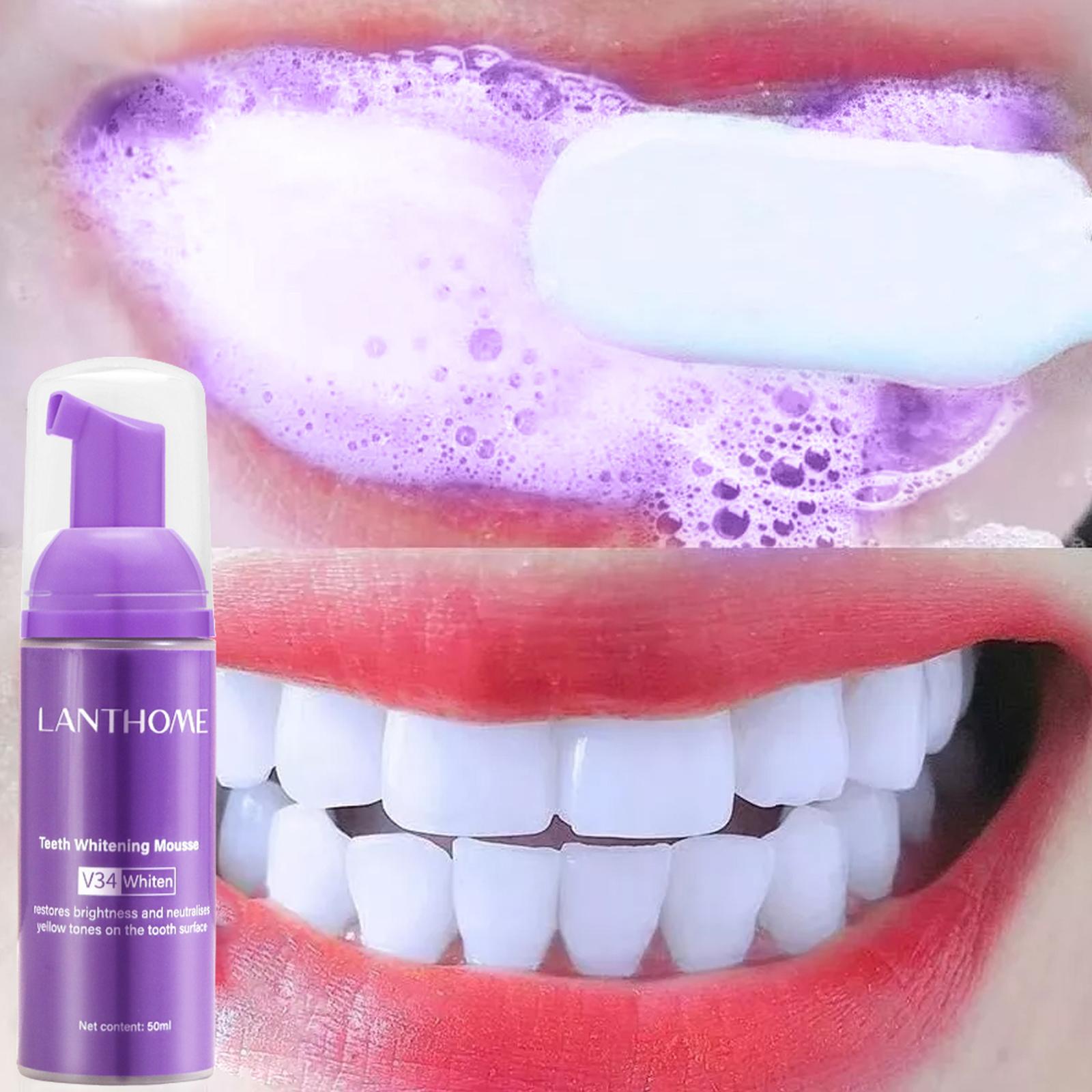 V34 Mousse Teeth Cleaning Toot - огляд і ціна Teeth Whitening Crest