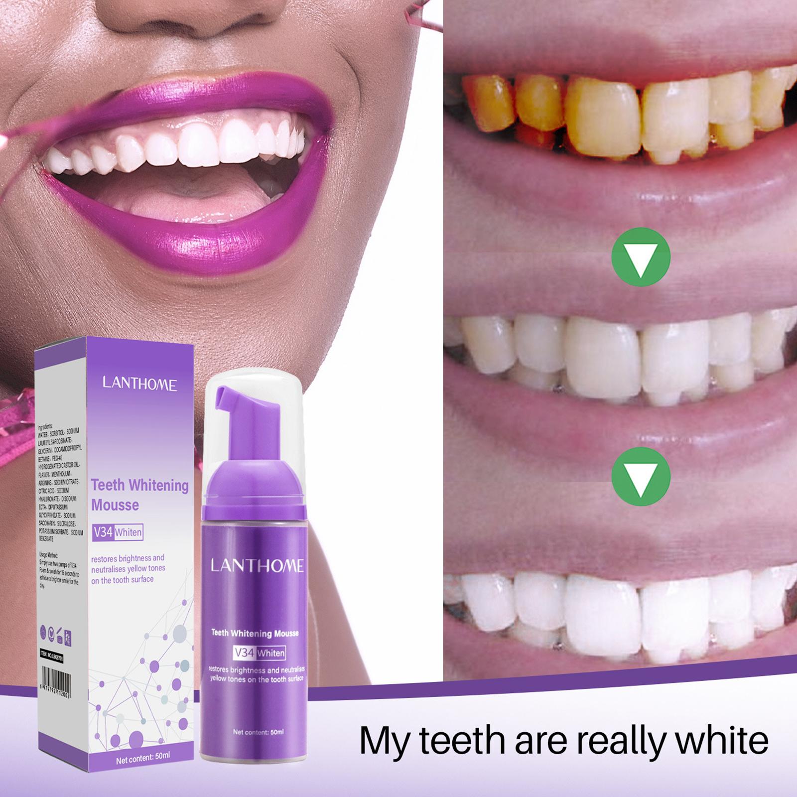 V34 Mousse Teeth Cleaning Toot - огляд і ціна Teeth Whitening Crest