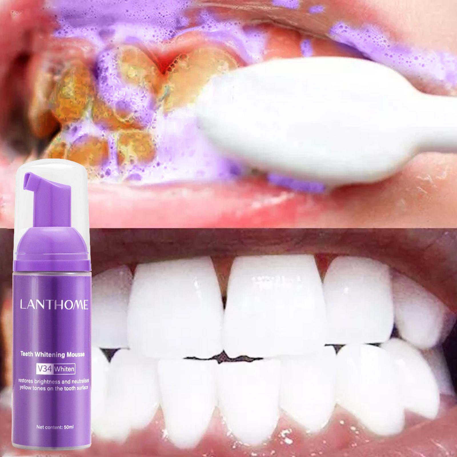 V34 Mousse Teeth Cleaning Toot - огляд і ціна Teeth Whitening Crest