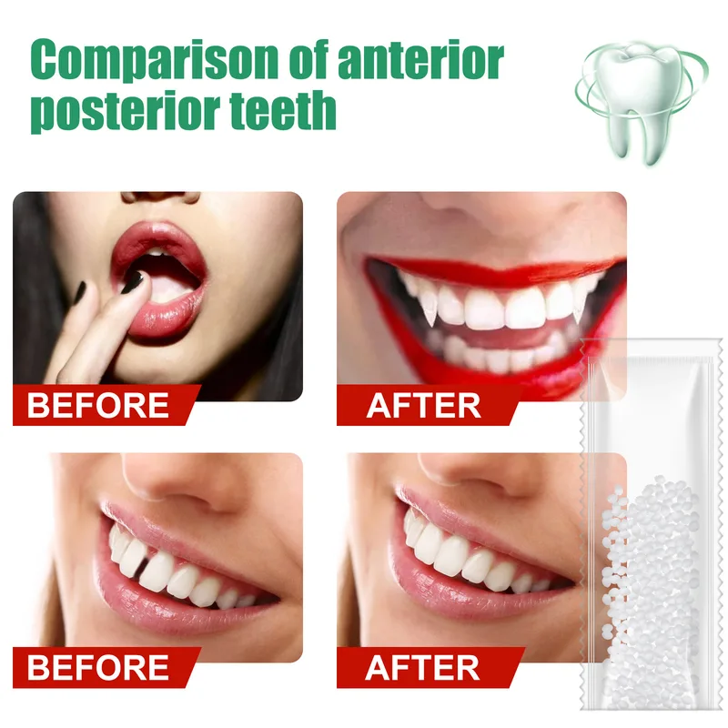 10g50g/30ml Resin Tooth Repair - огляд і ціна Teeth Whitening At Home