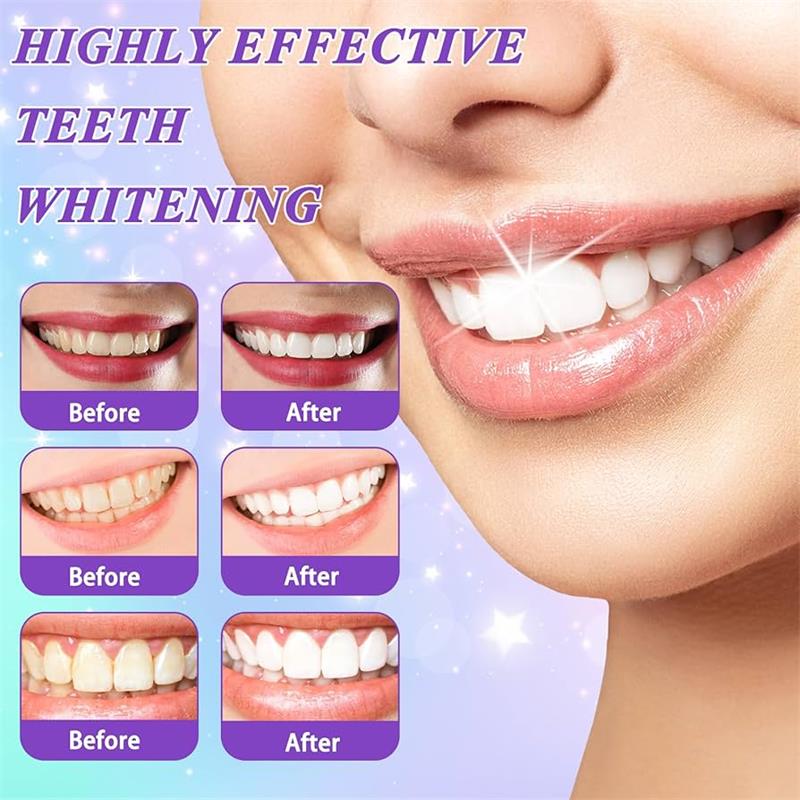 9D Purple Teeth Whitening Toot - огляд і ціна Teeth Whitening Naturally