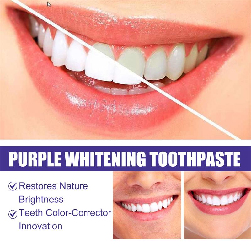 9D Purple Teeth Whitening Toot - огляд і ціна Teeth Whitening Naturally