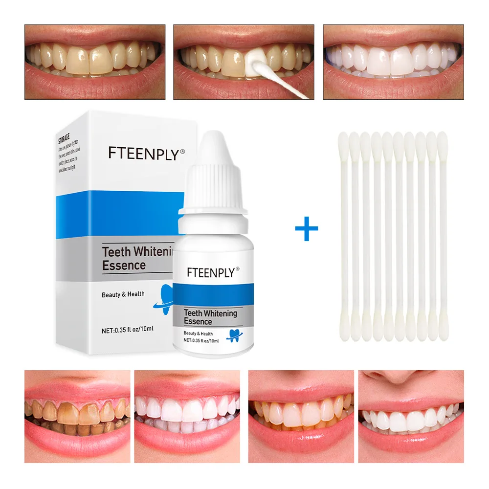 FTEENPLY Teeth Whitening Essen - огляд і ціна Teeth Whitening At Home