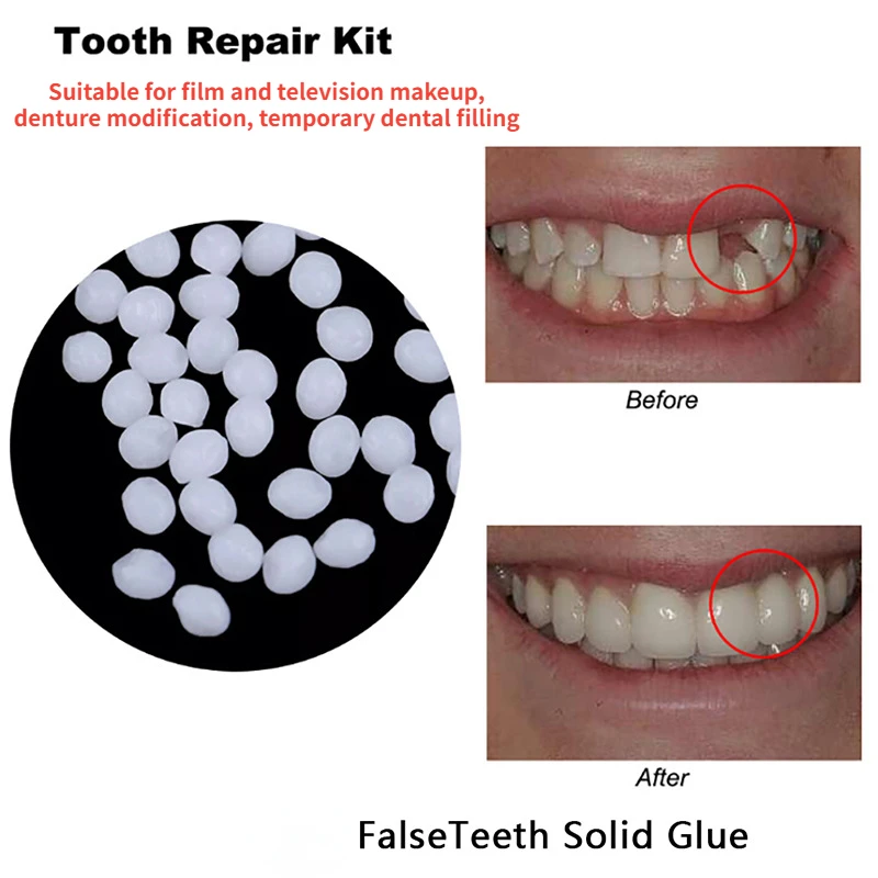 Tooth Repair Glue Shapeable Te - огляд і ціна Teeth Whitening At Home