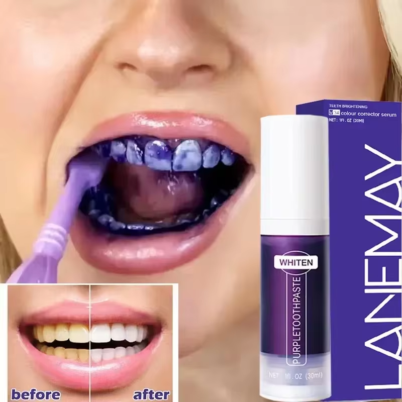 V34 Purple Teeth Whitening Too - огляд і ціна Teeth Whitening Crest