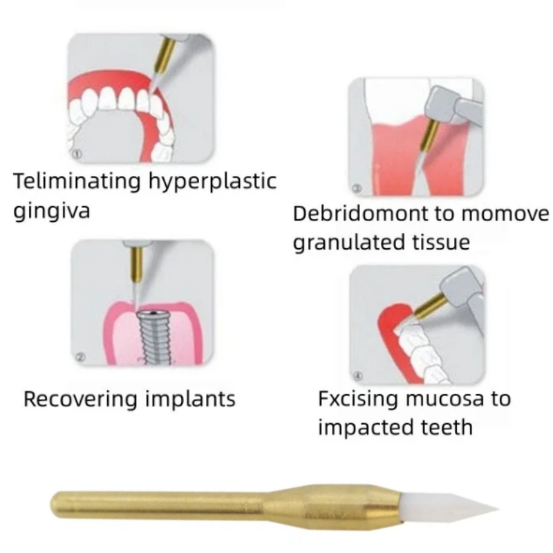 Dental Soft Trimmer Burs Surgi - огляд і ціна Teeth Whitening Gum